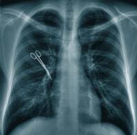 avvocato_roma_malasanita_errore_medico